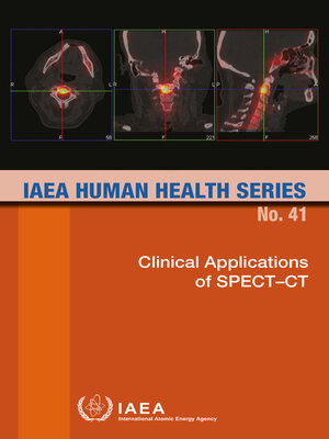 cover image of Clinical Applications of SPECT–CT
